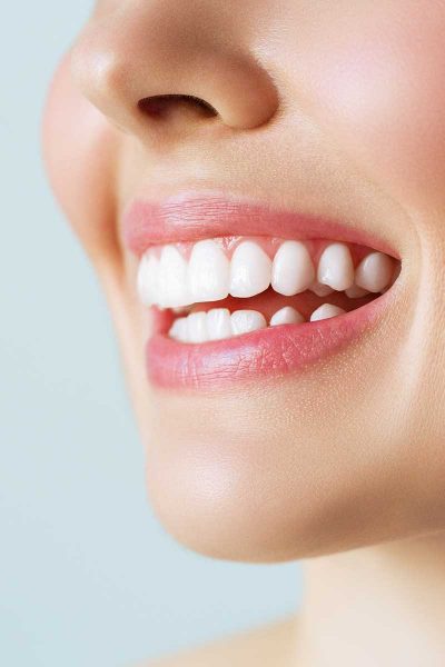 teeth-whitening-home